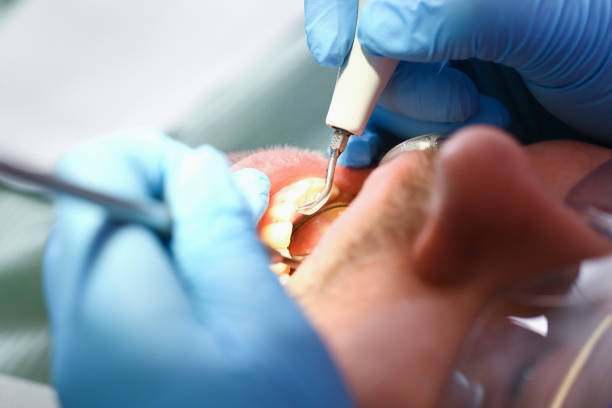 Best Broken or Chipped Tooth Repair in Grangeville, ID