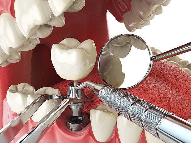 Best Emergency Orthodontic Repairs in Grangeville, ID